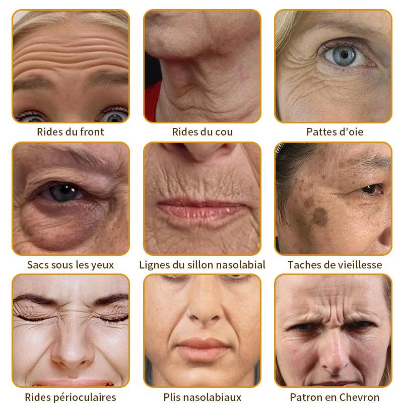 🎄 Offre spéciale de saison : –60 % sur la crème TLOPA® Botox Bee Venom pour une peau plus ferme et liftée 🐝✨