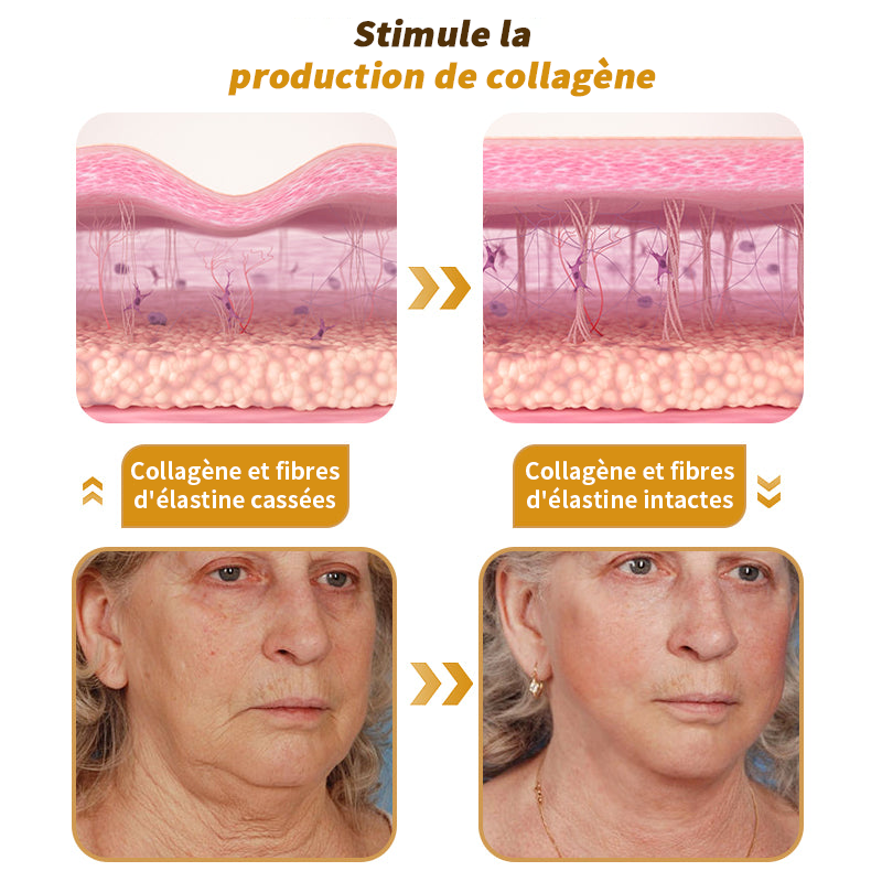 🎄 Offre spéciale de saison : –60 % sur la crème TLOPA® Botox Bee Venom pour une peau plus ferme et liftée 🐝✨