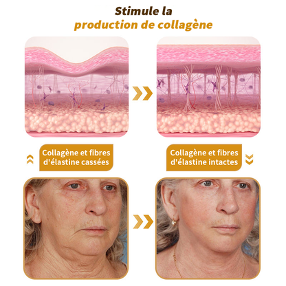 🎄 Offre spéciale de saison : –60 % sur la crème TLOPA® Botox Bee Venom pour une peau plus ferme et liftée 🐝✨