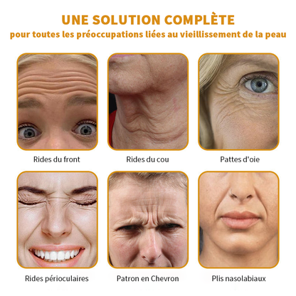 🎄 Offre spéciale de saison : –60 % sur la crème TLOPA® Botox Bee Venom pour une peau plus ferme et liftée 🐝✨