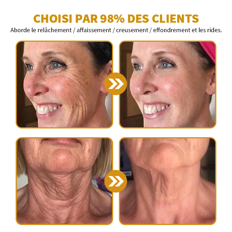 🎄 Offre spéciale de saison : –60 % sur la crème TLOPA® Botox Bee Venom pour une peau plus ferme et liftée 🐝✨