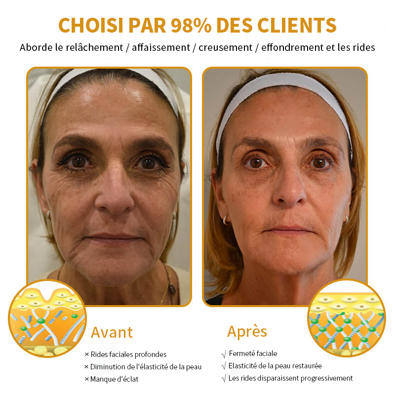 🎄 Offre spéciale de saison : –60 % sur la crème TLOPA® Botox Bee Venom pour une peau plus ferme et liftée 🐝✨