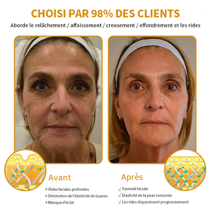 🎄 Offre spéciale de saison : –60 % sur la crème TLOPA® Botox Bee Venom pour une peau plus ferme et liftée 🐝✨