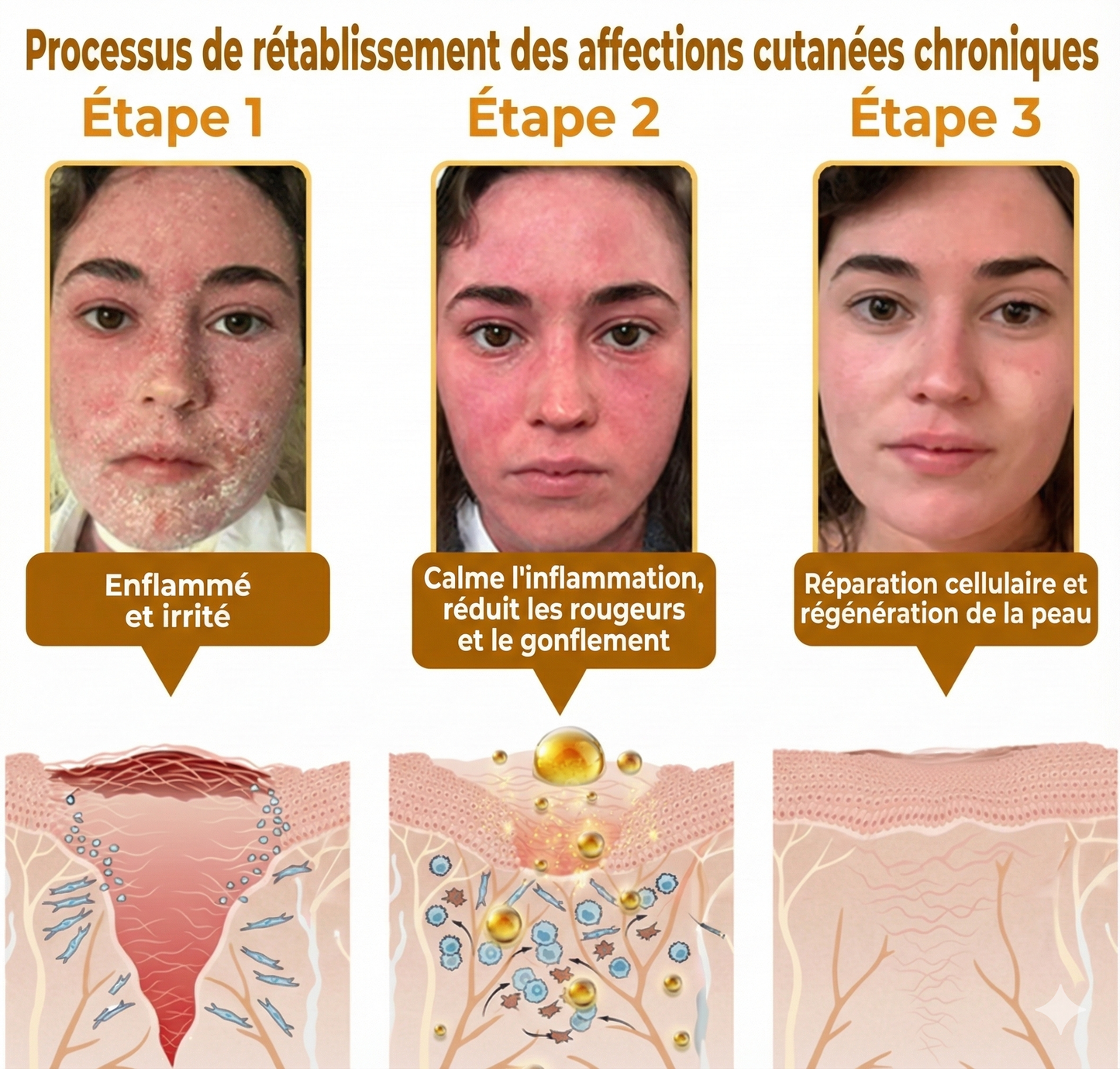 Fabriqué et expédié depuis la France 🇫🇷 ✨ Crème régénératrice au venin d'abeille Solaroza® Puissant anti-âge. Respectueux des abeilles. ⏰ DERNIER JOUR -80% 💖