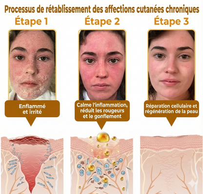 Fabriqué et expédié depuis la France 🇫🇷 ✨ Crème régénératrice au venin d'abeille Solaroza® Puissant anti-âge. Respectueux des abeilles. ⏰ DERNIER JOUR -80% 💖