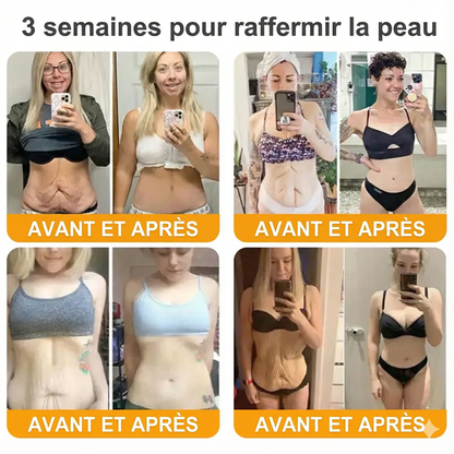 Fabriqué et expédié depuis la France 🇫🇷 ✨ Crème régénératrice au venin d'abeille Solaroza® Puissant anti-âge. Respectueux des abeilles. ⏰ DERNIER JOUR -80% 💖