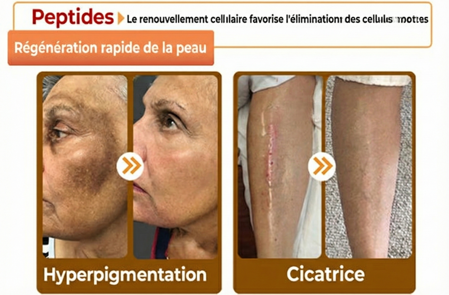 Fabriqué et expédié depuis la France 🇫🇷 ✨ Crème régénératrice au venin d'abeille Solaroza® Puissant anti-âge. Respectueux des abeilles. ⏰ DERNIER JOUR -80% 💖