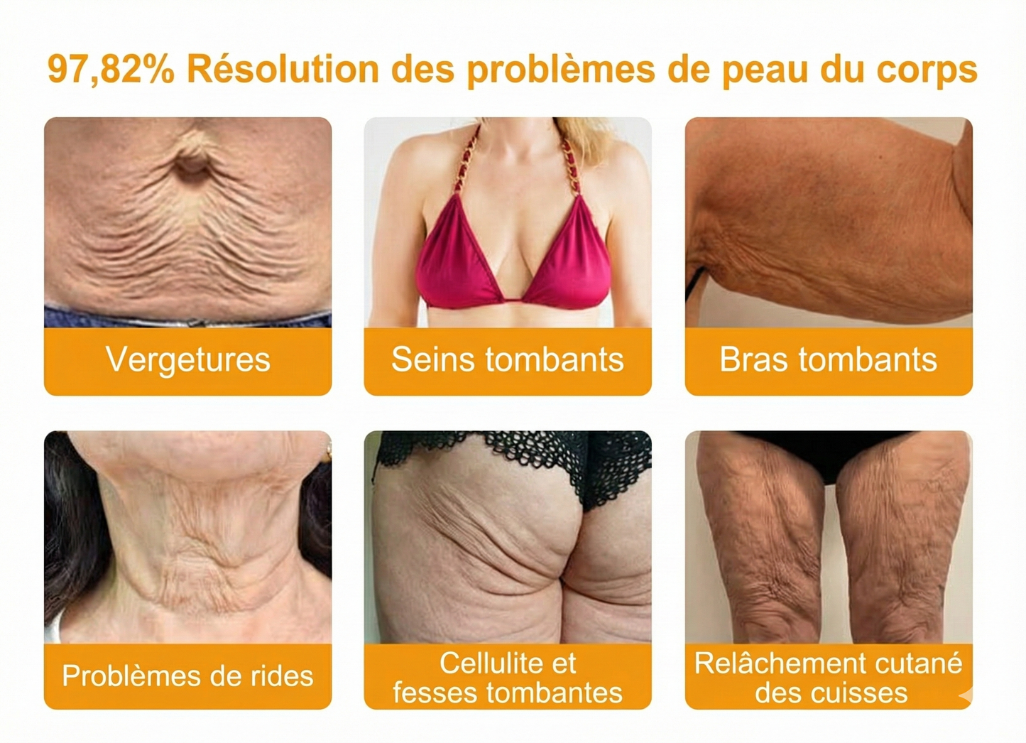 Fabriqué et expédié depuis la France 🇫🇷 ✨ Crème régénératrice au venin d'abeille Solaroza® Puissant anti-âge. Respectueux des abeilles. ⏰ DERNIER JOUR -80% 💖