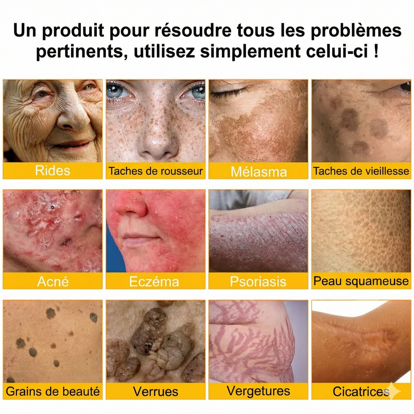 Fabriqué et expédié depuis la France 🇫🇷 ✨ Crème régénératrice au venin d'abeille Solaroza® Puissant anti-âge. Respectueux des abeilles. ⏰ DERNIER JOUR -80% 💖