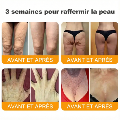 Fabriqué et expédié depuis la France 🇫🇷 ✨ Crème régénératrice au venin d'abeille Solaroza® Puissant anti-âge. Respectueux des abeilles. ⏰ DERNIER JOUR -80% 💖