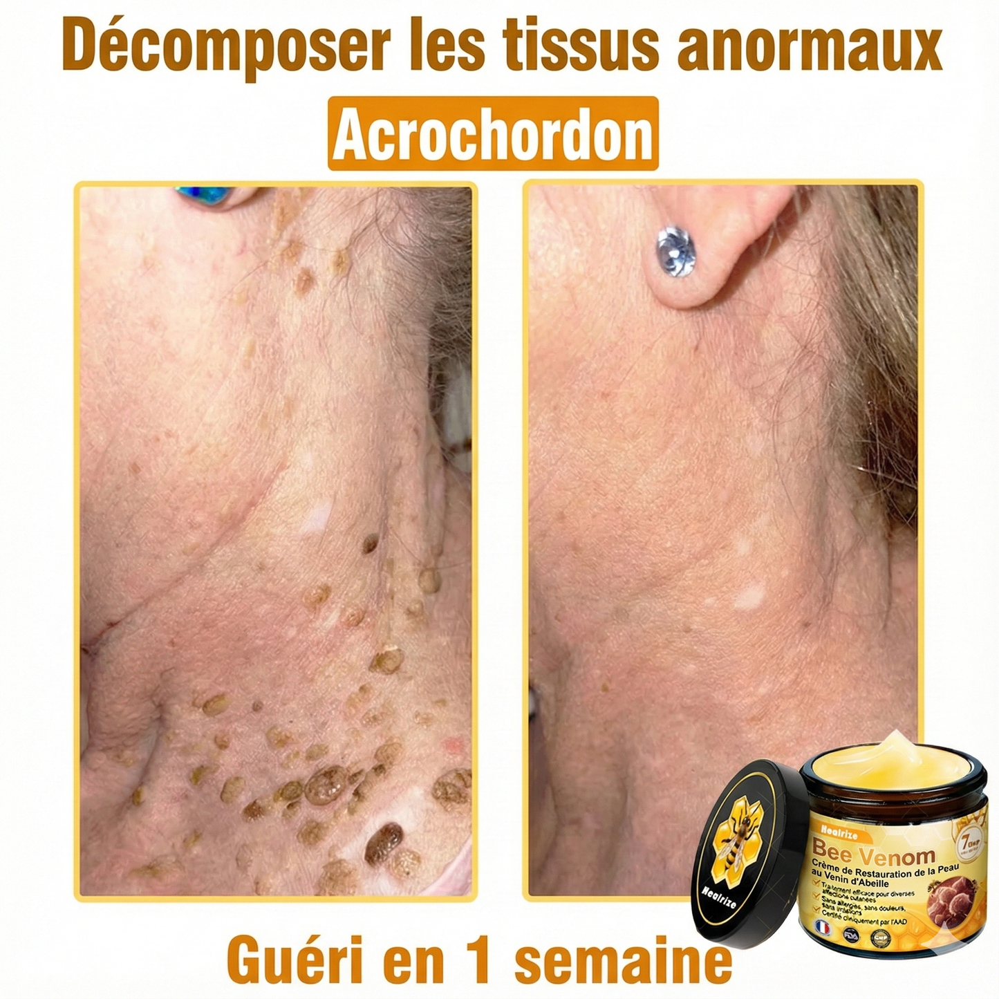 Fabriqué et expédié depuis la France 🇫🇷 ✨ Crème régénératrice au venin d'abeille Solaroza® Puissant anti-âge. Respectueux des abeilles. ⏰ DERNIER JOUR -80% 💖