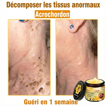 Fabriqué et expédié depuis la France 🇫🇷 ✨ Crème régénératrice au venin d'abeille Solaroza® Puissant anti-âge. Respectueux des abeilles. ⏰ DERNIER JOUR -80% 💖