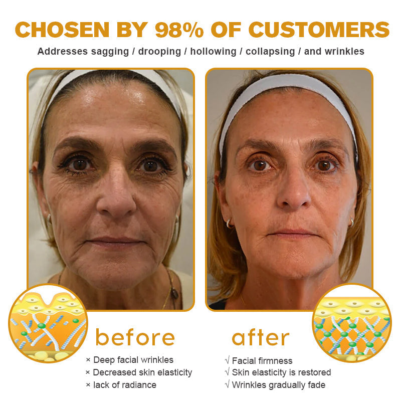🔥 Offre spéciale de saison : –60 % sur la crème TLOPA® Botox Bee Venom pour une peau plus ferme et liftée 🐝✨