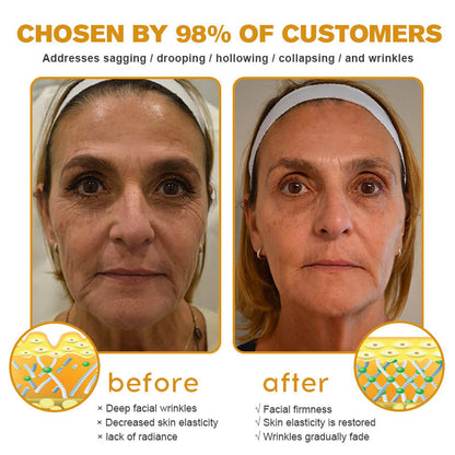 🔥 Offre spéciale de saison : –60 % sur la crème TLOPA® Botox Bee Venom pour une peau plus ferme et liftée 🐝✨