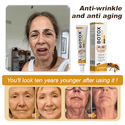 🔥 Offre spéciale de saison : –60 % sur la crème TLOPA® Botox Bee Venom pour une peau plus ferme et liftée 🐝✨
