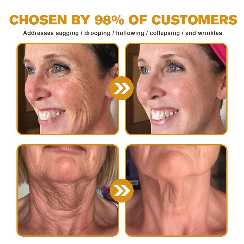 🔥 Offre spéciale de saison : –60 % sur la crème TLOPA® Botox Bee Venom pour une peau plus ferme et liftée 🐝✨