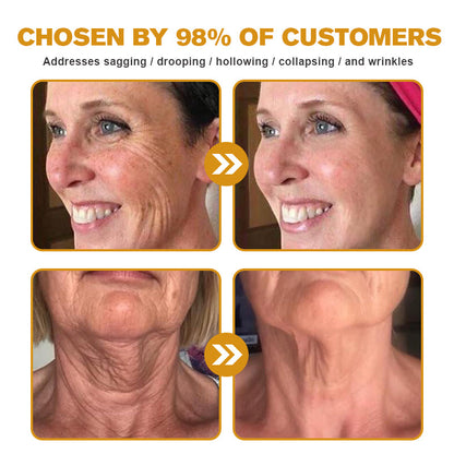 🔥 Offre spéciale de saison : –60 % sur la crème TLOPA® Botox Bee Venom pour une peau plus ferme et liftée 🐝✨