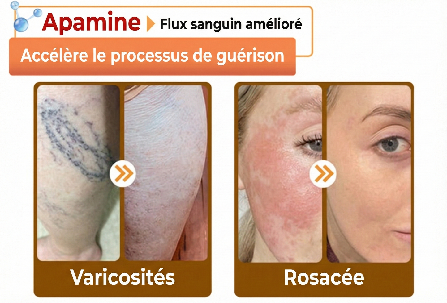 Fabriqué et expédié depuis la France 🇫🇷 ✨ Crème régénératrice au venin d'abeille Solaroza® Puissant anti-âge. Respectueux des abeilles. ⏰ DERNIER JOUR -80% 💖